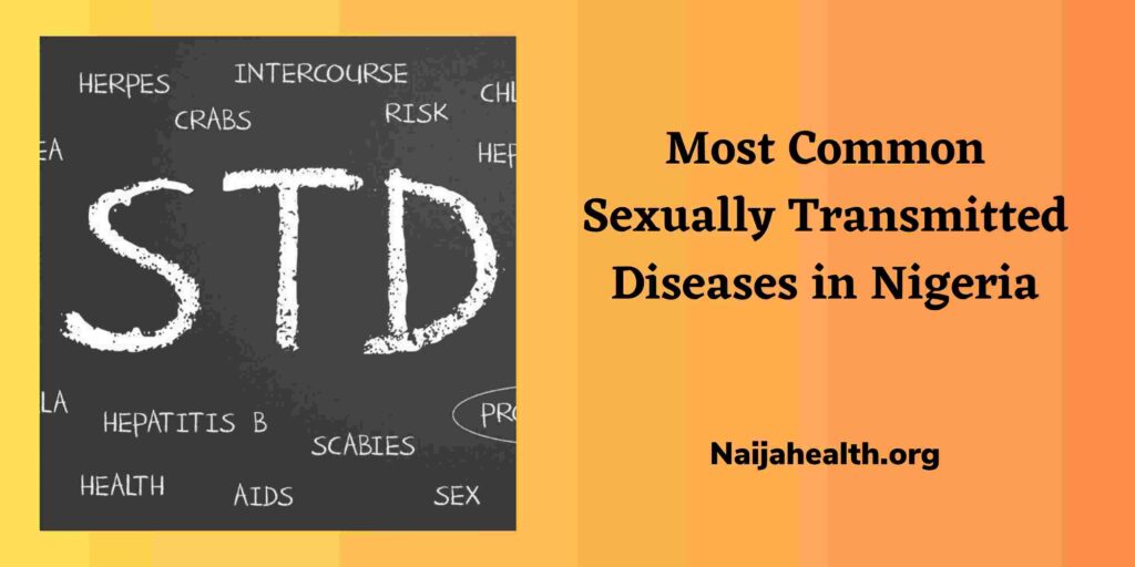 Most Common Sexually Transmitted Diseases in Nigeria