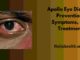 Apollo Eye Disease: Prevention, Symptoms, and Treatment